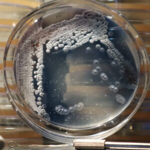 Preserved Streptomyces coelicolor